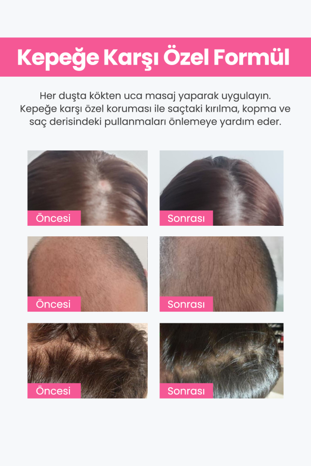Keratin 4'lü Saç Seti + Kutulu Gönderim