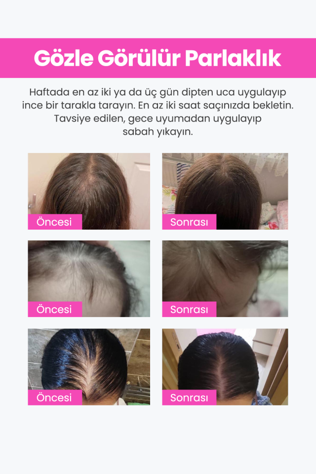 Keratin 4'lü Saç Seti + Kutulu Gönderim